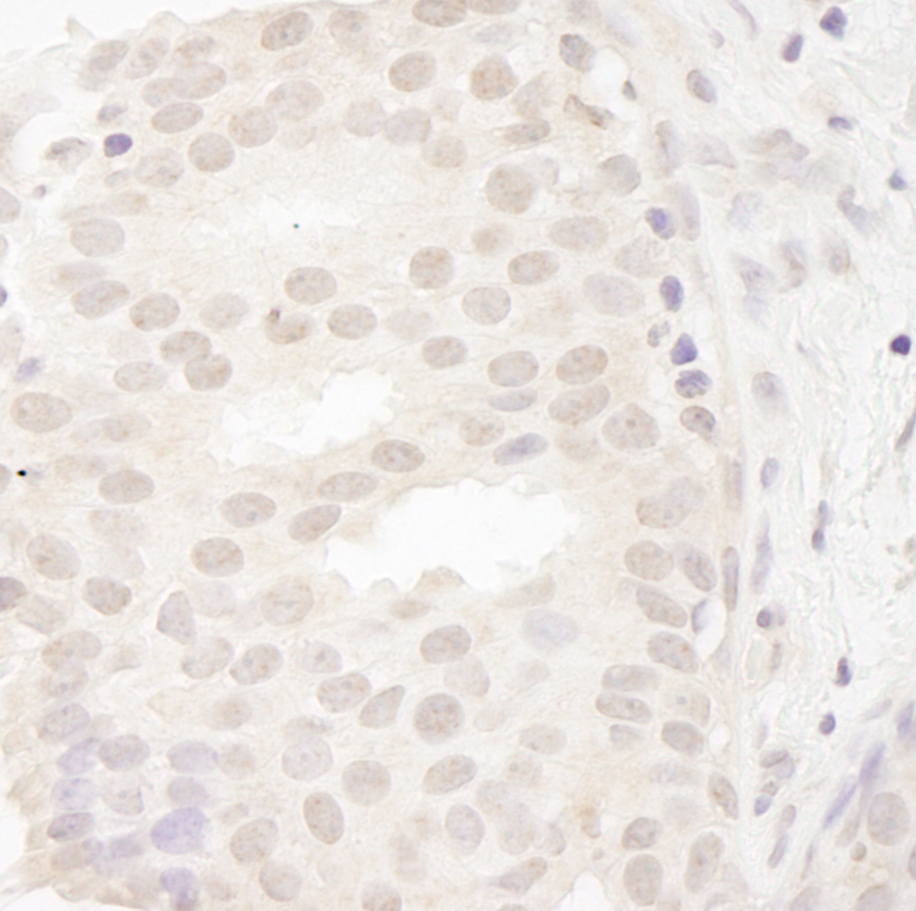 Rabbit anti-CASC5 IHC Antibody