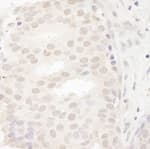 Detection of human CASC5 by immunohistochemistry.