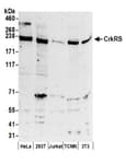 Detection of human and mouse CrkRS by western blot.