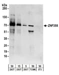 Detection of human and mouse ZNF358 by western blot.