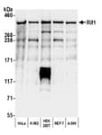 Detection of human Rif1 by western blot.
