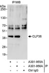 Detection of human CLP36 by western blot of immunoprecipitates.