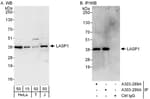 Detection of human LASP1 by western blot and immunoprecipitation.