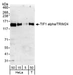 Detection of human TIF1 alpha/TRIM24 by western blot.