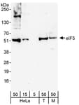 Detection of human and mouse eIF5 by western blot.