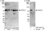 Detection of human and mouse CPSF73 by western blot (h&amp;m) and immunoprecipitation (h).