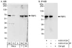 Detection of human and mouse FBP3 by western blot (h&amp;m) and immunoprecipitation (h).
