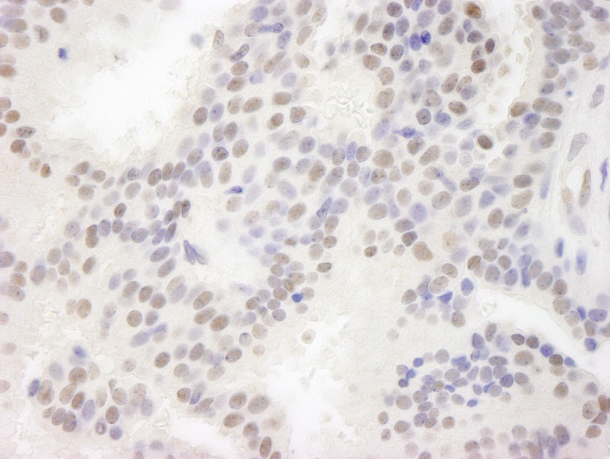 Rabbit anti-MAML3 IHC Antibody