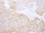Detection of mouse eEF2 Kinase by immunohistochemistry.