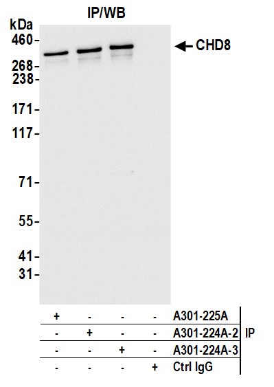 Detection of human CHD8 by western blot of immunoprecipitates.