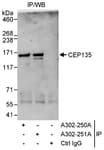 Detection of human CEP135 by western blot of immunoprecipitates.