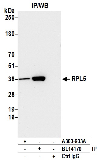 Detection of human RPL5 by western blot of immunoprecipitates.