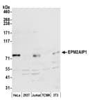 Detection of human and mouse EPM2AIP1 by western blot.
