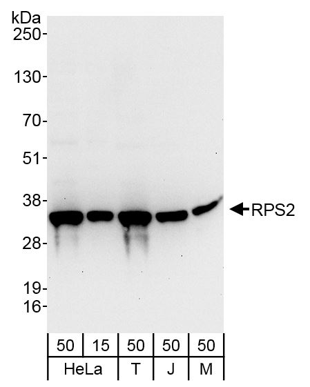 Detection of human and mouse RPS2 by western blot.