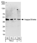 Detection of human I kappa B-beta by western blot.