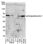Detection of human and mouse Sequestosome-1 by western blot.