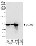 Detection of human SAMHD1 by western blot.