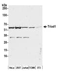 Detection of human and mouse Triad1 by western blot.