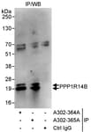 Detection of human PPP1R14B by western blot of immunoprecipitates.