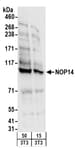 Detection of mouse NOP14 by western blot.