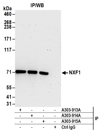 Detection of human NXF1 by western blot of immunoprecipitates.