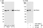 Detection of human KPNA3 by western blot and immunoprecipitation.
