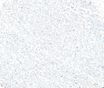 Detection of mouse FOXP3 by immunohistochemistry.