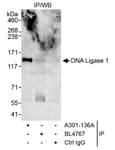 Detection of human DNA Ligase 1 by western blot of immunoprecipitates.