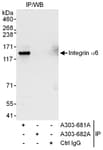 Detection of human Integrin Alpha 6 by western blot of immunoprecipitates.