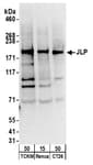 Detection of mouse JLP by western blot.