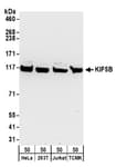 Detection of human and mouse KIF5B by western blot.