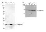 Detection of mouse Galectin 7 by western blot and immunoprecipitation.