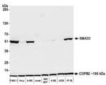 Detection of human SMAD3 by western blot.