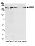 Detection of human CHD6 by western blot.
