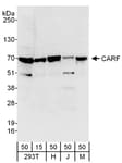 Detection of human and mouse CARF by western blot.