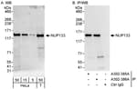 Detection of human NUP133 by western blot and immunoprecipitation.