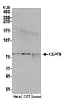 Detection of human CEP78 by western blot.