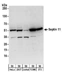 Detection of human and mouse Septin 11 by western blot.