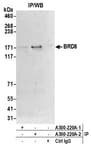 Detection of human BRD8 by western blot of immunoprecipitates.