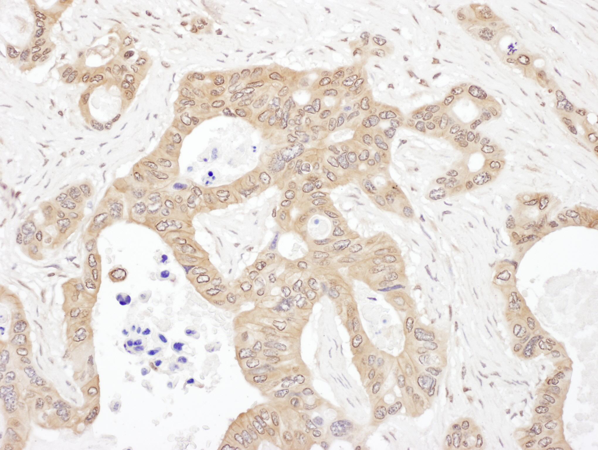 Detection of human LARS by immunohistochemistry.