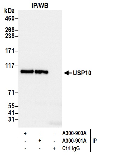 Detection of human BIG1/ARFGEF1 by western blot of immunoprecipitates.