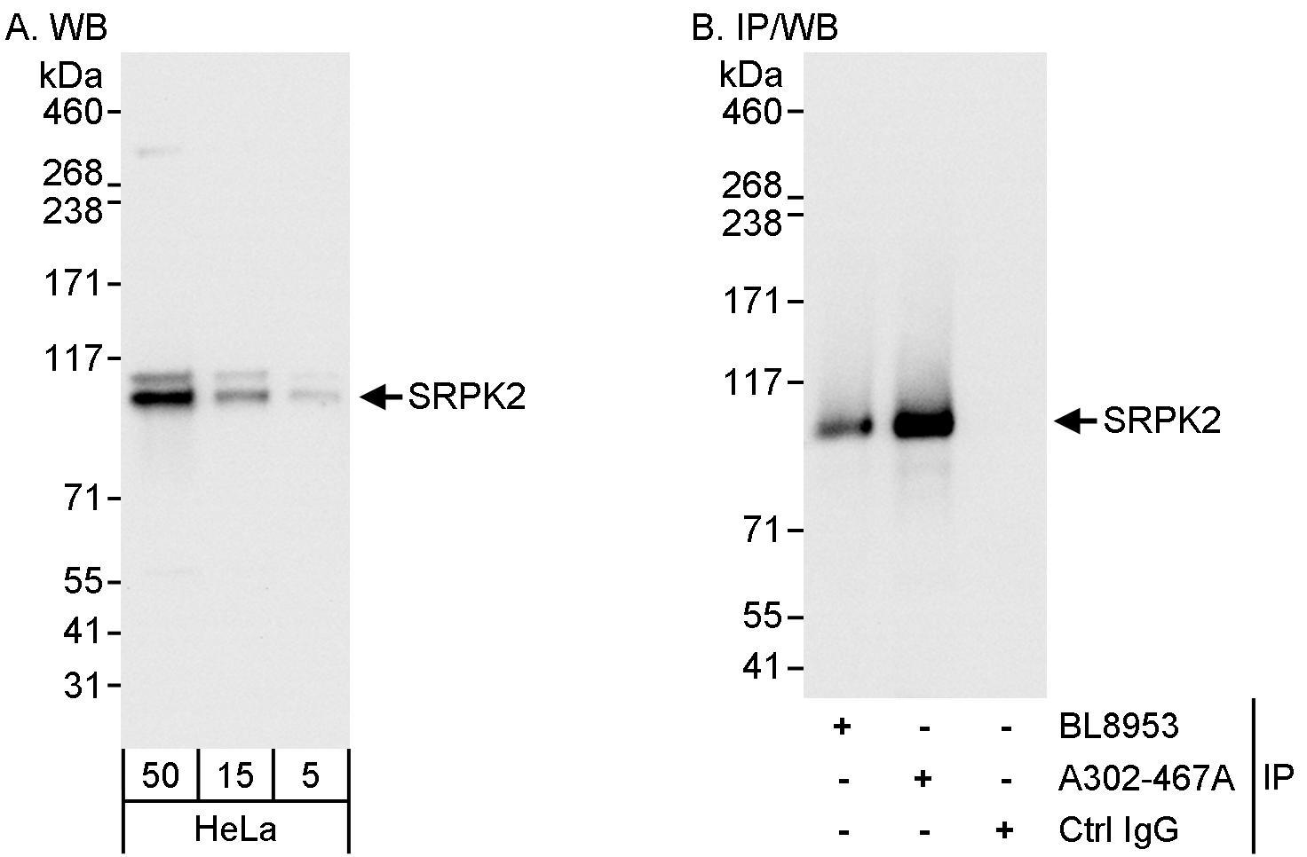 Detection of human SRPK2 by western blot and immunoprecipitation.