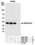 Detection of human RNASEH2A by western blot of immunoprecipitates.