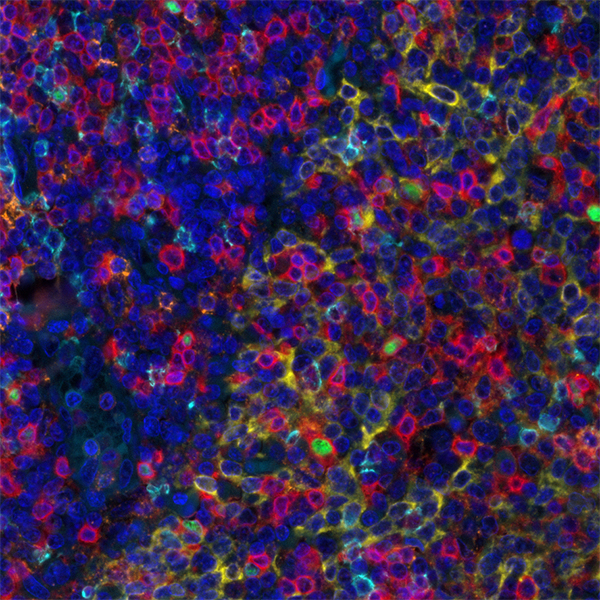 T Cell Maturation PathPlex Panel (CD8 alpha, Cytokeratin, CD45RO, CD4, FOXP3)