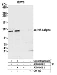 Detection of human HIF2-alpha by western blot of immunoprecipitates.