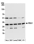 Detection of human and mouse RSU1 by western blot.