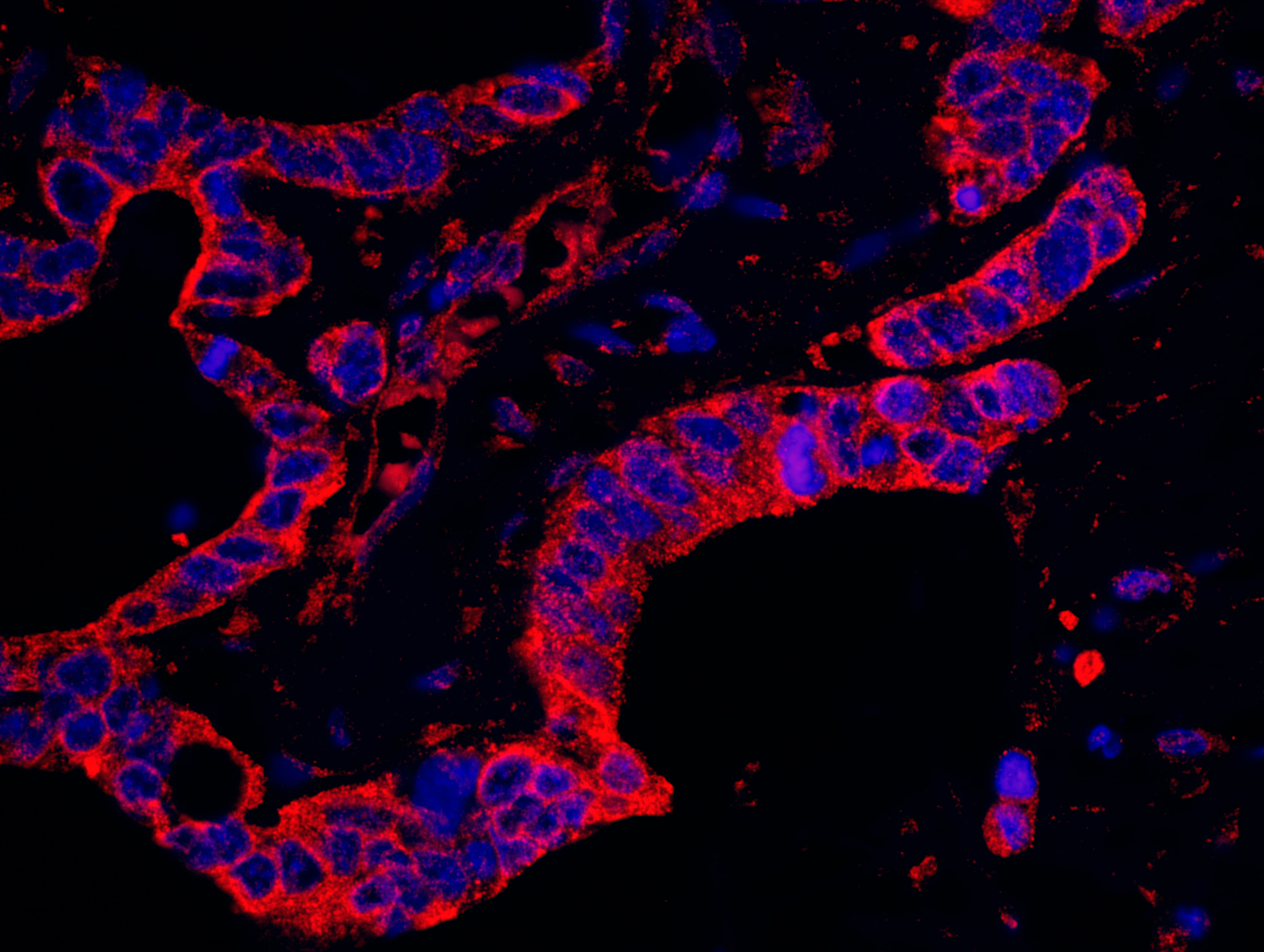 Rabbit anti-DAP5 IHC Antibody