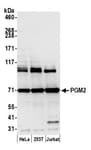 Detection of human PGM2 by western blot.