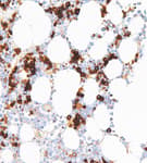 Detection of human TfR by immunohistochemistry.