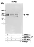 Detection of human NF1 by western blot of immunoprecipitates.